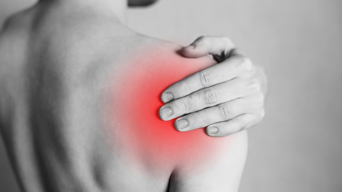 Shoulder Gout | Complete Guide to Uric Acid | Uricacid.help